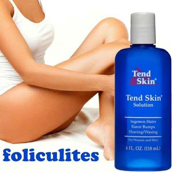 TEND SKIN SOLUTION 118ML (P/ FOLICULITE E PELOS ENCRAVADOS)
